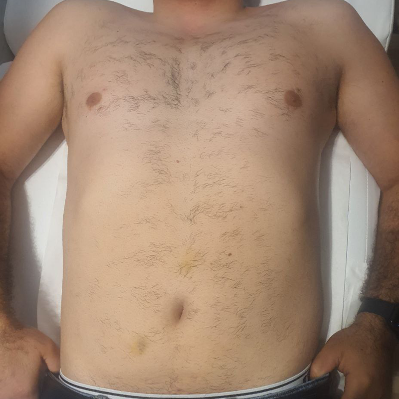 Before after - 800x800 - 7 - 2